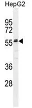 Fetuin A (AHSG) (C-term) Rabbit Polyclonal Antibody - image 1