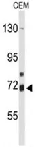 15 Lipoxygenase 2 (ALOX15B) (C-term) Rabbit Polyclonal Antibody - image 1