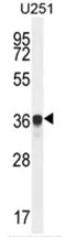 AMN1 (N-term) Rabbit Polyclonal Antibody - image 1