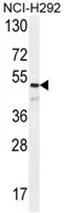 Angiopoietin 1 (ANGPT1) (C-term) Rabbit Polyclonal Antibody - image 1