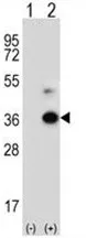 Angiopoietin like 7 (ANGPTL7) (C-term) Rabbit Polyclonal Antibody - image 1