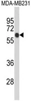 ANKRD13C (N-term) Rabbit Polyclonal Antibody - image 1