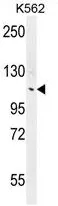 ANKRD18B (N-term) Rabbit Polyclonal Antibody - image 1