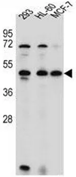 ANKRD40 (C-term) Rabbit Polyclonal Antibody - image 1