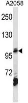 AP2B1 (Center) Rabbit Polyclonal Antibody - image 1