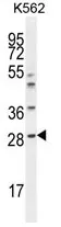 Serum Amyloid P (APCS) (C-term) Rabbit Polyclonal Antibody - image 1