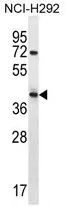 ARRDC5 (N-term) Rabbit Polyclonal Antibody - image 1