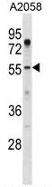 TUG (ASPSCR1) (N-term) Rabbit Polyclonal Antibody - image 1