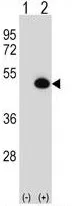 ASS1 (C-term) Rabbit Polyclonal Antibody - image 1