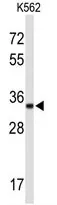 ATP1B2 (Center) Rabbit Polyclonal Antibody - image 1