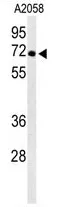 ATP6V1A (Center) Rabbit Polyclonal Antibody - image 1