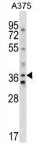 AVPR1A (C-term) Rabbit Polyclonal Antibody - image 1