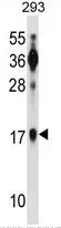 BATF (N-term) Rabbit Polyclonal Antibody - image 1