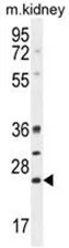 BCL10 (N-term) Rabbit Polyclonal Antibody - image 1