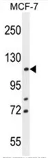 BTF (BCLAF1) (C-term) Rabbit Polyclonal Antibody - image 1