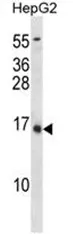 Osteocalcin (BGLAP) (C-term)/(C-term C80) Rabbit Polyclonal Antibody - image 1
