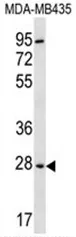 BPGM (C-term) Rabbit Polyclonal Antibody - image 1