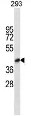 BVES (C-term) Rabbit Polyclonal Antibody - image 1