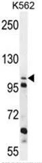 C4orf21 (ZGRF1) (N-term) Rabbit Polyclonal Antibody - image 1