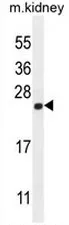 CALML4 (C-term) Rabbit Polyclonal Antibody - image 1