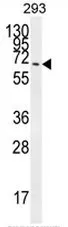 CCDC37 (CFAP100) (N-term) Rabbit Polyclonal Antibody - image 1