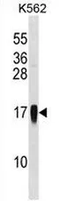 MCP3 (CCL7) (Center) Rabbit Polyclonal Antibody - image 1