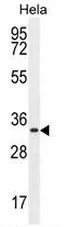 Cyclin H (CCNH) (C-term) Rabbit Polyclonal Antibody - image 1