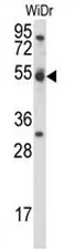 Cyclin (CCNI) (C-term) Rabbit Polyclonal Antibody - image 1