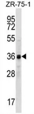 CCNYL2 (Center) Rabbit Polyclonal Antibody - image 1
