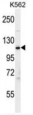 Factor H (CFH) (Center) Rabbit Polyclonal Antibody - image 1