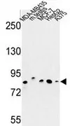 CHPF (Center) Rabbit Polyclonal Antibody - image 1