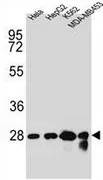CHPT1 (N-term) Rabbit Polyclonal Antibody - image 1