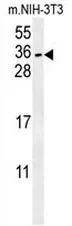 CITED2 (C-term) Rabbit Polyclonal Antibody - image 1