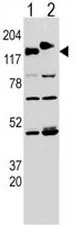 CLASP2 Rabbit Polyclonal Antibody - image 1