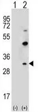 Claudin 2 (CLDN2) (C-term Y195) Rabbit Polyclonal Antibody - image 1