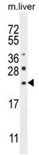 CLEC2L (N-term) Rabbit Polyclonal Antibody - image 1