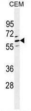 CLEC4F (C-term) Rabbit Polyclonal Antibody - image 1