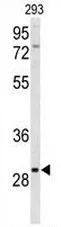 CLRN3 (C-term) Rabbit Polyclonal Antibody - image 1