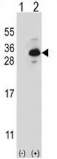 Clathrin light chain (CLTB) Rabbit Polyclonal Antibody - image 1
