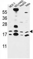 CNPY2 (C-term) Rabbit Polyclonal Antibody - image 1