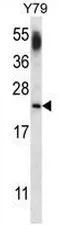 CNRIP1 (Center) Rabbit Polyclonal Antibody - image 1