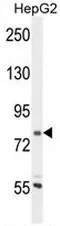 CORO7 (N-term) Rabbit Polyclonal Antibody - image 1