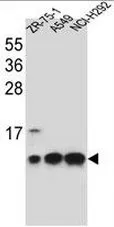 Cytochrome C Oxidase subunit VIb (COX6B1) (C-term) Rabbit Polyclonal Antibody - image 1