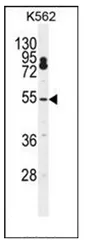 CPSF7 (C-term) Rabbit Polyclonal Antibody - image 1