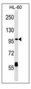CPT1C (C-term) Rabbit Polyclonal Antibody - image 1