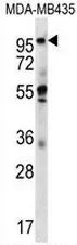 CTAGE5 (MIA2) (C-term) Rabbit Polyclonal Antibody - image 1