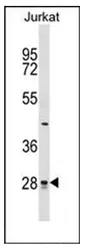 CTDSP1 (N-term) Rabbit Polyclonal Antibody - image 1
