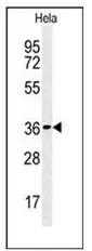 CTDSPL (N-term) Rabbit Polyclonal Antibody - image 1