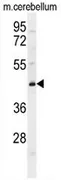CYB5D2 (C-term) Rabbit Polyclonal Antibody - image 1