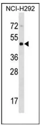 PSCD4 (CYTH4) (C-term) Rabbit Polyclonal Antibody - image 1